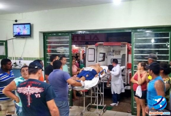 Policial reformado é baleado no rosto em Esperantina