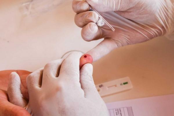 Piauí chega a 102.813 casos confirmados e 2.237 mortes pelo novo coronavírus