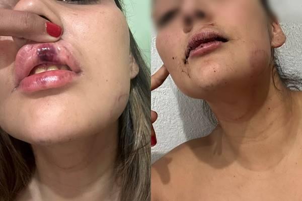 Engenheira denuncia namorado e termina relação após agressões em via pública em Pedro II