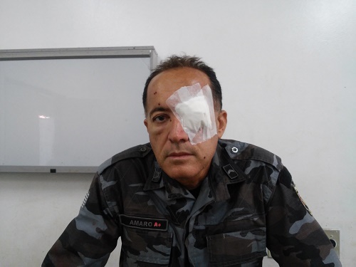 PMs de Floriano são feridos durante troca de tiros na região de Francisco Ayres