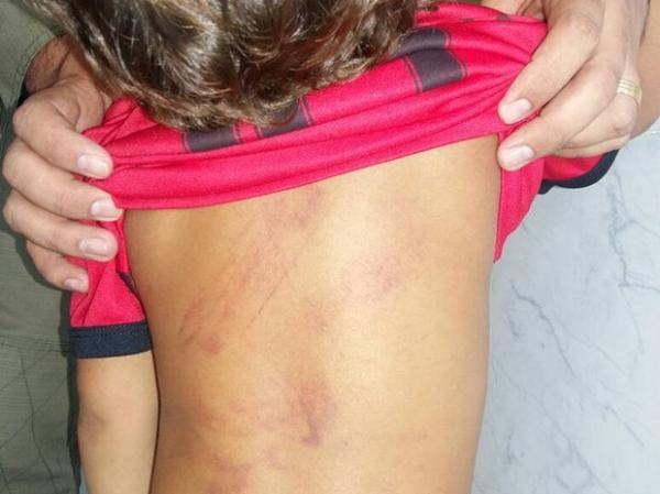 Criança de três anos é espancada na cidade de Parnaíba; mãe é suspeita