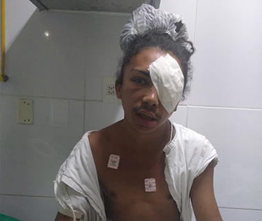 Travesti perde olho esquerdo após tentativa de homicídio