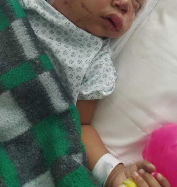 Bebê de 2 anos que perdeu os pais em tragédia de SP tem alta da UTI e segue estável