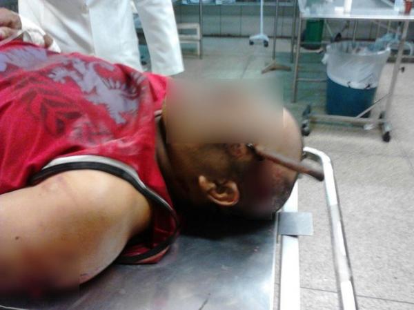 Homem fica com faca cravada na cabeça após agressão no interior do PI