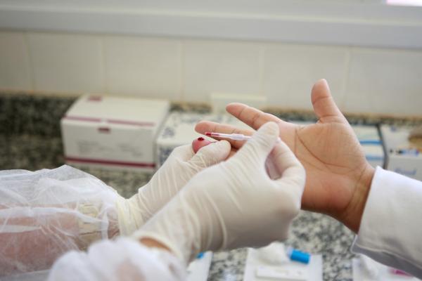 Índice de pessoas com HIV deixa Floriano em 2º lugar no Piauí